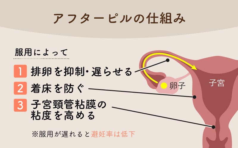 アフターピルの仕組み