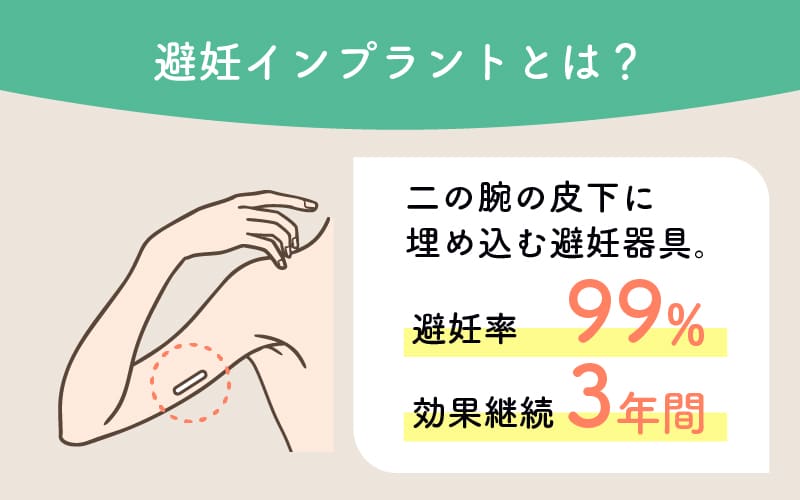 避妊インプラントとは？二の腕の皮下に埋め込む避妊器具