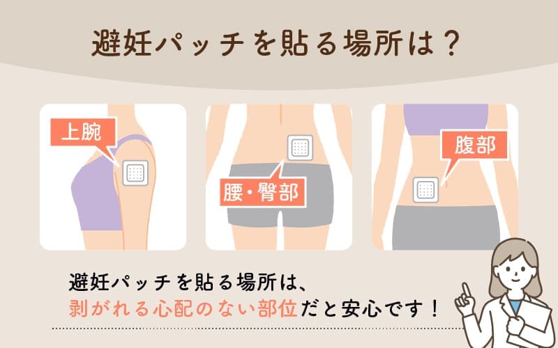 避妊パッチを貼るおすすめの場所は上腕、腰、腹部、臀部