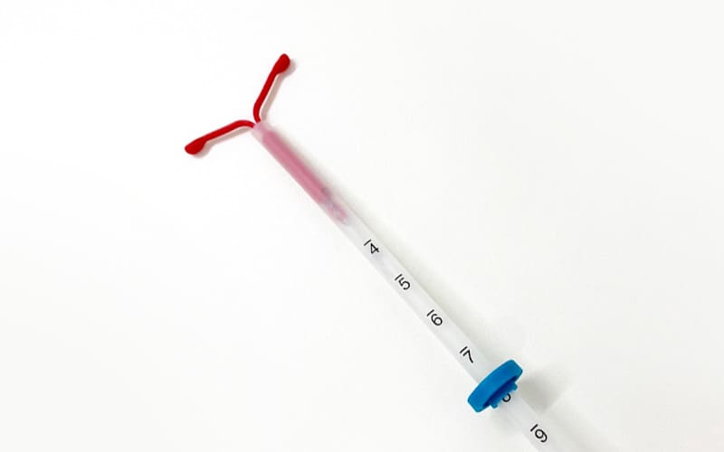 ミレーナ実物の写真