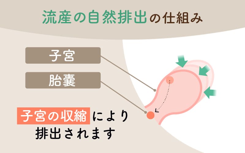 流産の自然排出の仕組みを図で解説。